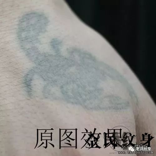 激光洗纹身,不留疤,皮秒,阳春市,阳东县,阳西县 . “怎么样洗纹身，才能伤害小又不留疤？” “用